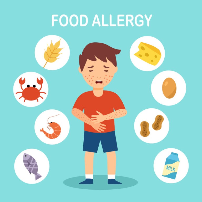 تغذیه در آلرژی های غذایی - دکتر فود